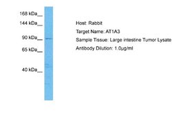 Sodium Potassium ATPase Alpha 3 Antibody, Novus Biologicals 100 &mu;L;